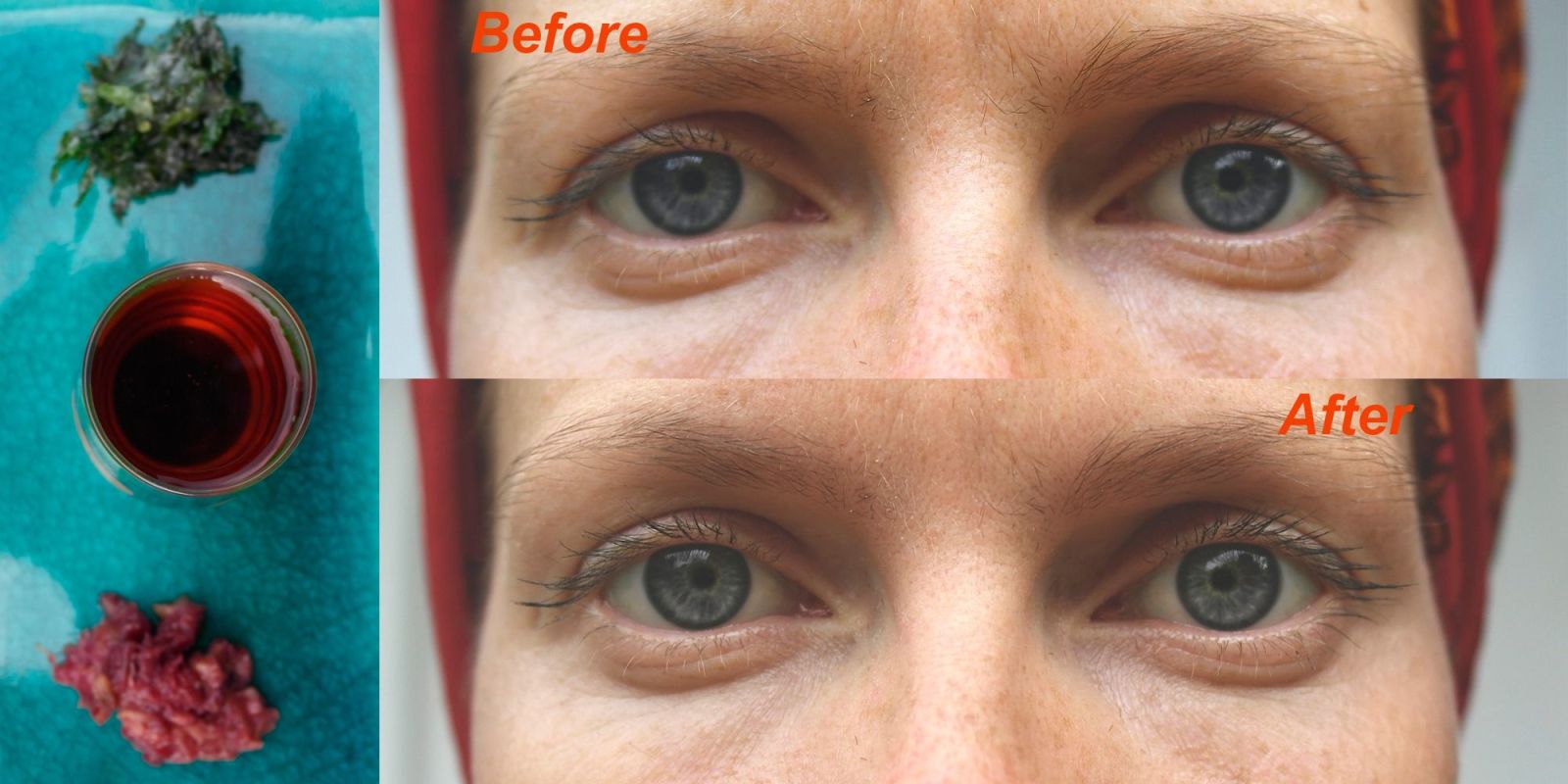 Natural Remedies For Sleepy Eyes Natural Remedies For Sleepy Eyes