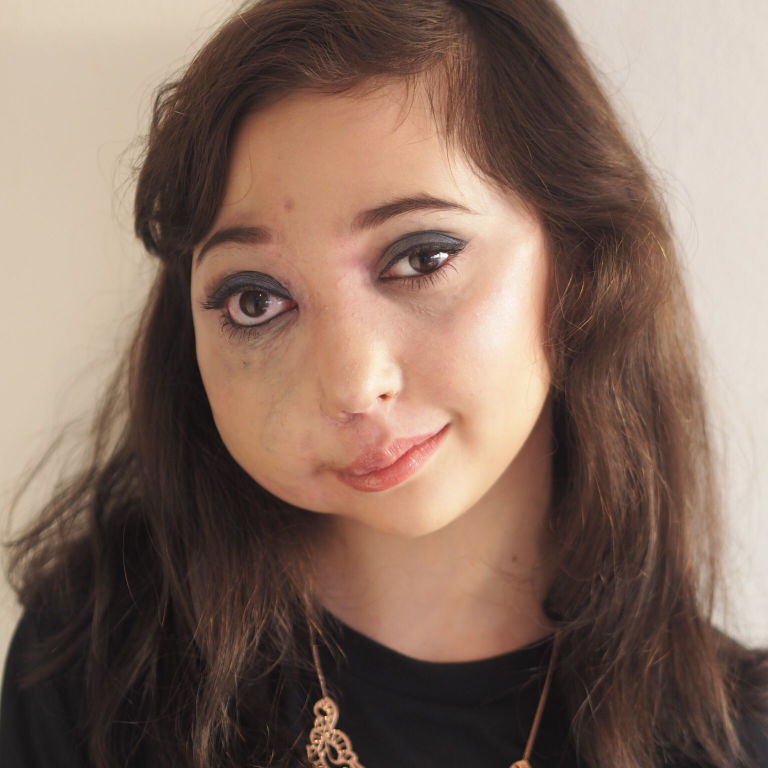 Meet the inspiring 11 year old beauty vlogger with a rare health condition