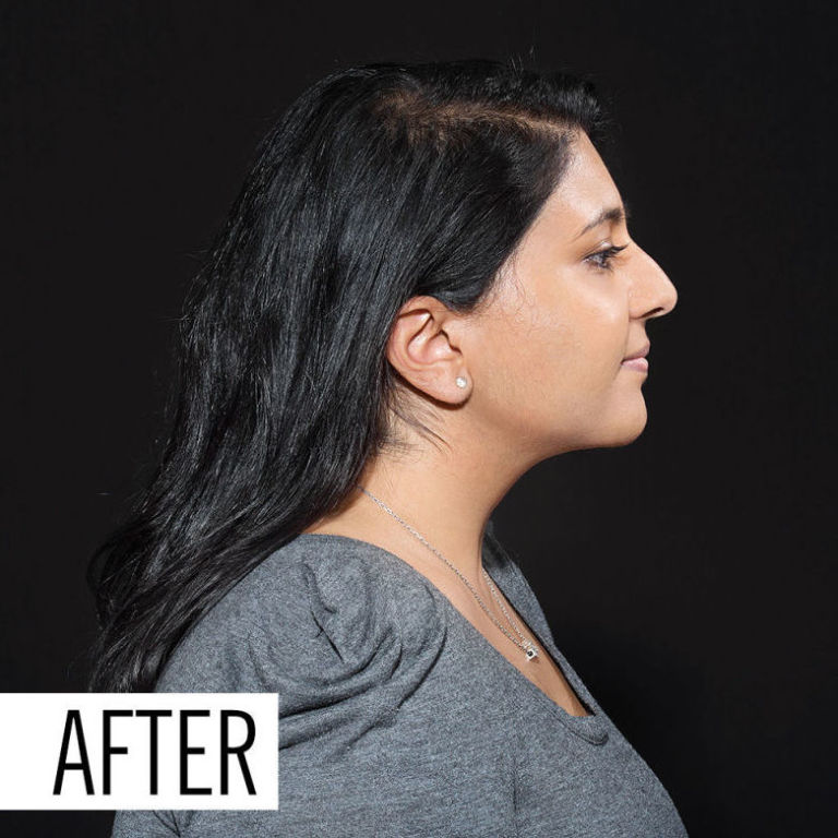 Jawline Contouring Tutorial How to Contour Your Jaw for More Definition