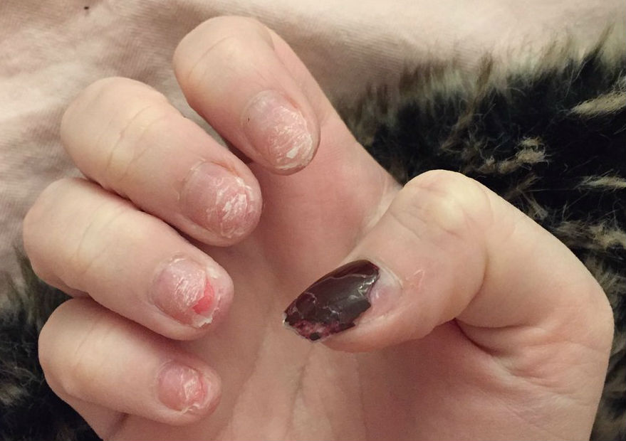 Avoid Nail Damage With Proper Gel Polish Removal Technique How To Take Acrylic Nails Off Without Ruining Your Nail